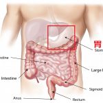 胃がんのつらさと不安──食べられない苦しさと、緩和ケアでできる支え