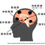 脳腫瘍の不安とつらさ、そして緩和ケア──「症状が出る前」から支えが必要な理由