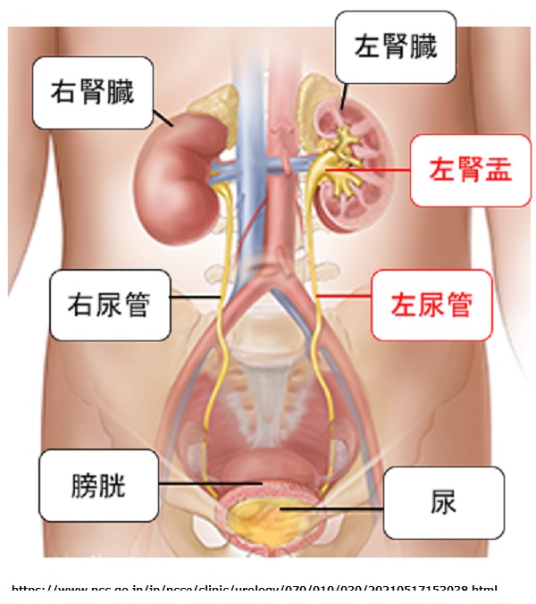 腎細胞がんの緩和ケア
